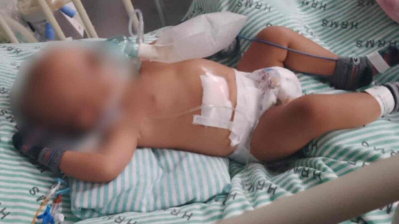 Mãe faz apelo para doação de fraldas ao filho internado após nascer com intestino para fora