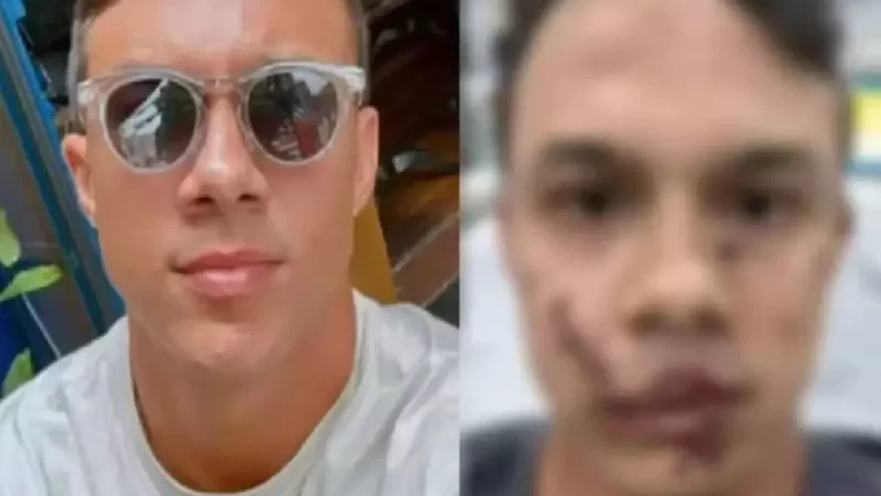 Personal trainer leva 45 pontos no rosto após ser agredido ao defender vítimas de assédio