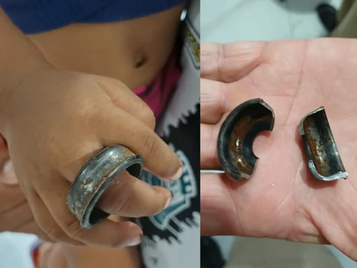 Criança prende peça de bicicleta no dedo e Corpo de Bombeiros é acionado