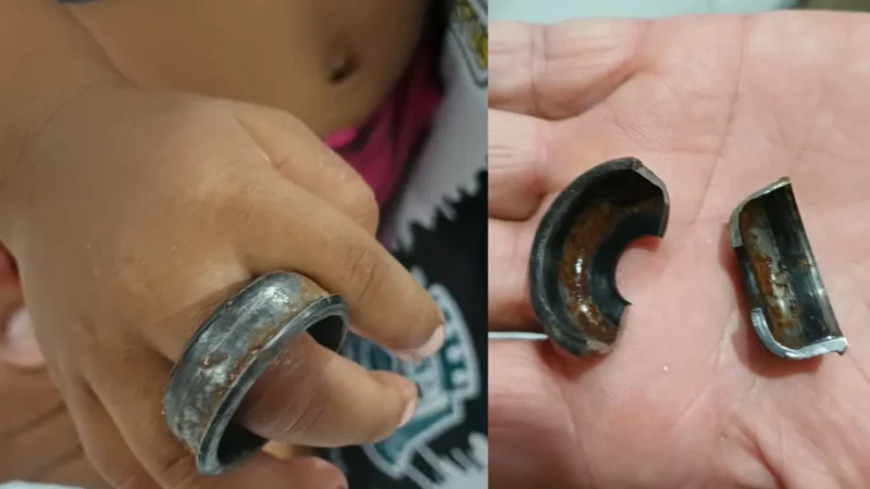 Criança prende peça de bicicleta no dedo e Corpo de Bombeiros é acionado