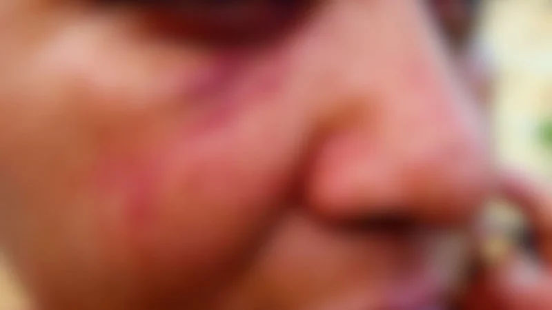 ‘Medo de morrer’: espancada e mantida em cárcere há anos pelo marido é resgatada em Campo Grande