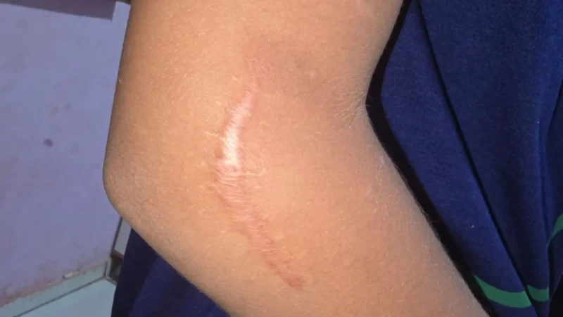 Mães relatam novos casos de negligência nas UPAs após morte de menino de 9 anos